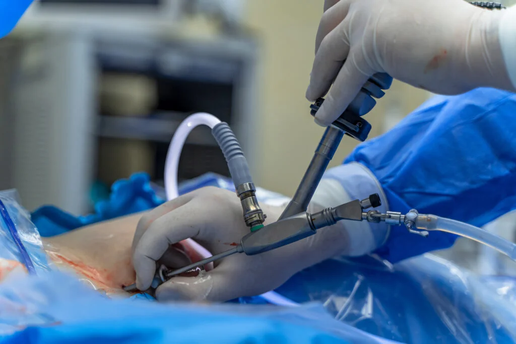 Alt="Best Laparoscopic Surgeons in Noida Sector 50"/>